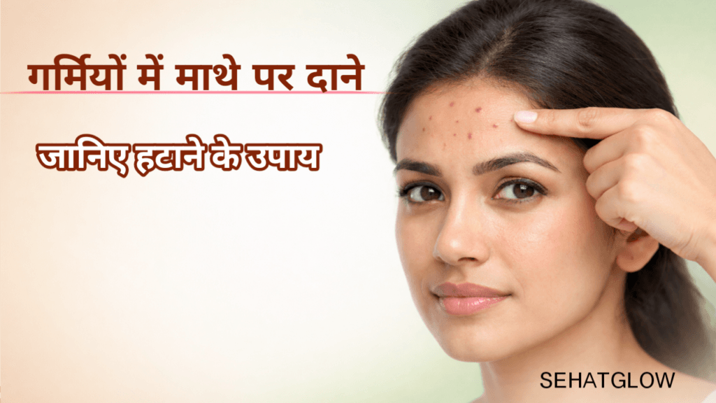 Garmiyo me mathe par dane kyo nikalte hai. Sehatglow