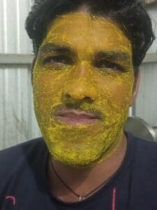 Chehra par haldi,besan or dahi lagane ke fayde sehatglow